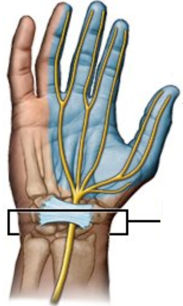 Imagen ilustrativa de síndrome del túnel carpiano